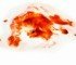 Facts About Ovulation Bleeding