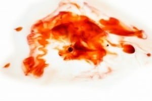 Reasons For Heavy Menstrual Bleeding