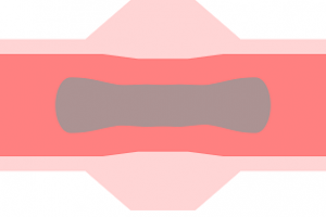 Having brown menstrual blood