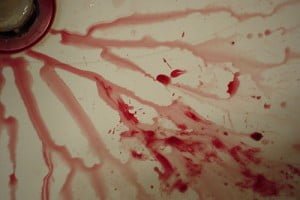 Bleeding During Pregnancy – Most Common Causes