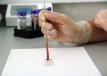 Taking a Blood Pregnancy Test