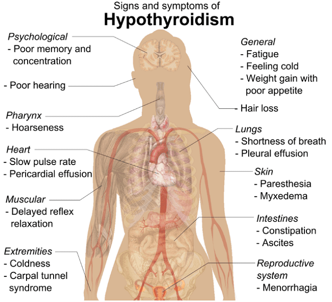 symptoms of hypothyroidism