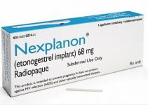 The Effects of Nexplanon on Menstrual Cycle