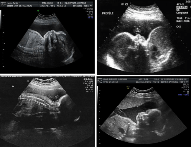 7 month ultrasound