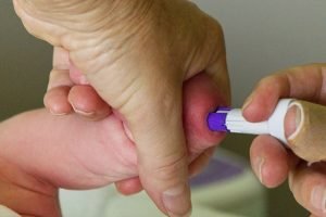 Low Blood Sugar in Newborns
