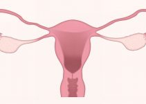 Menstrual Cycle After Tubal Ligation