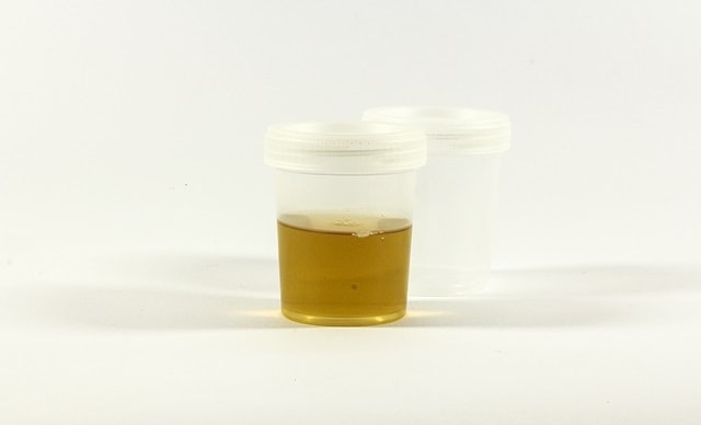 Can Cloudy Urine Be A Sign Of Early Pregnancy 